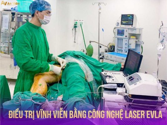 can thiệp laser