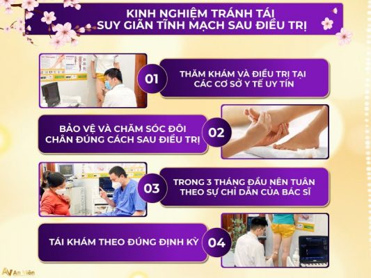 giãn tĩnh mạch chân là gì nên điều trị ở đâu