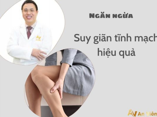 ngăn ngừa giãn tĩnh mạch