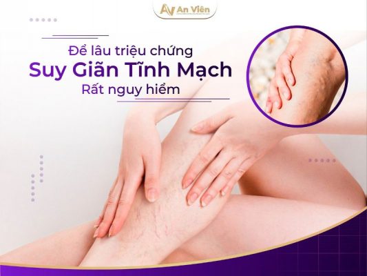 Hậu quả của suy giãn tĩnh mạch chi dưới