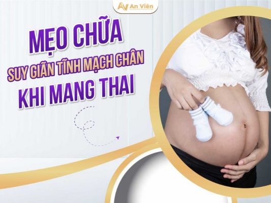 mẹo chữa suy giãn tĩnh mạch chân khi mang thai
