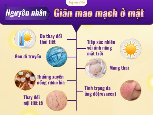 giãn tĩnh mạch hay còn được gọi là giãn mao mạch