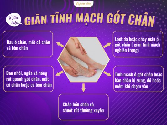 giãn tĩnh mạch gót chân