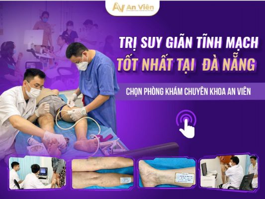 Điều trị bệnh tĩnh mạch tại Đà Nẵng