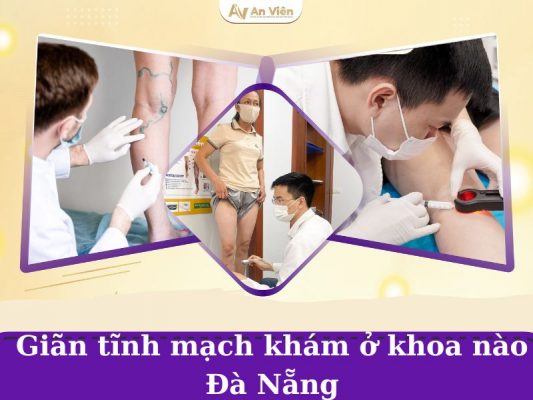 giãn tĩnh mạch khám khoa nào ở Đà Nẵng