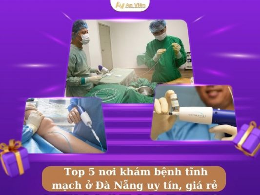 Nơi khám bệnh tĩnh mạch ở Đà Nẵng