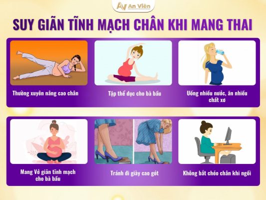 Mẽo chữa suy giãn tĩnh mạch chân cho bà bầu tại nhà