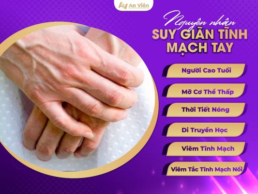 Suy giãn tĩnh mạch tay nguyên nhân do đâu?