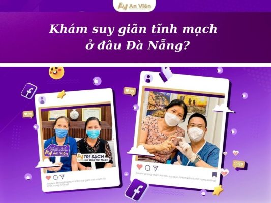 giãn tĩnh mạch khám ở đâu Đà Nẵng