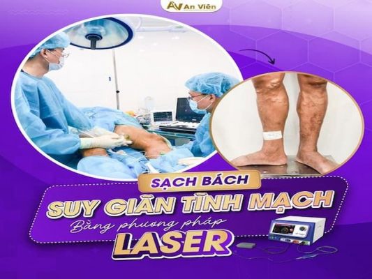 laser tĩnh mạch khám ở đâu Đà Nẵng