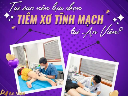 tiêm xơ tĩnh mạch An Viên