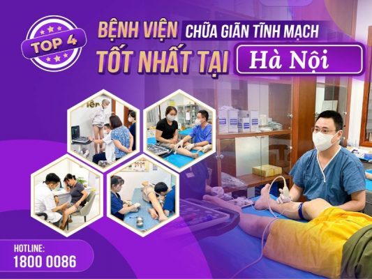 bệnh viện nào chữa giãn tĩnh mạch tốt nhất