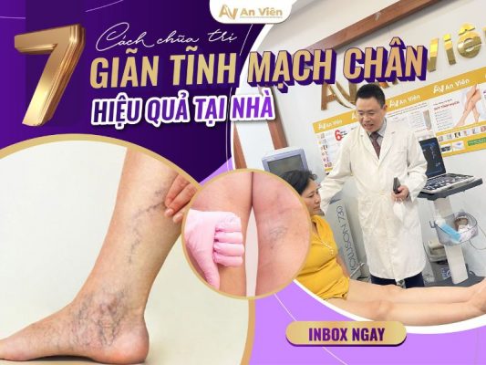 cách chữa trị giãn tĩnh mạch chân