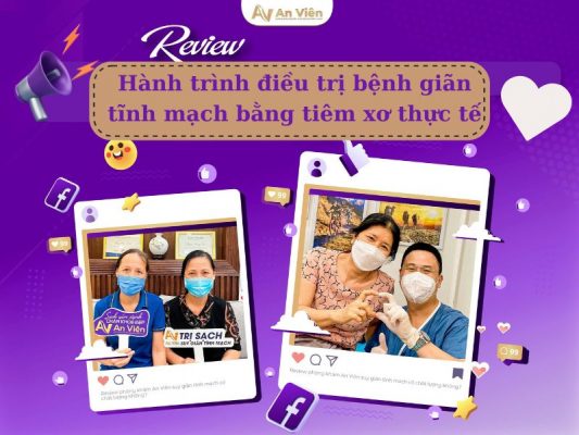 điều trị bệnh giãn tĩnh mạch
