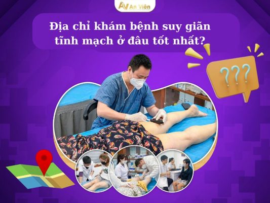 khám bệnh suy giãn tĩnh mạch ở đâu