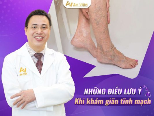 khám giãn tĩnh mạch