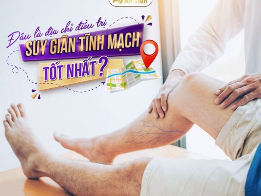 khám giãn tĩnh mạch chân ở đâu