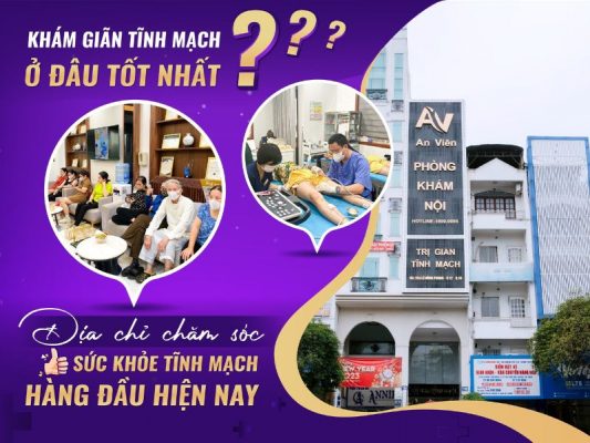 khám suy giãn tĩnh mạch ở đâu
