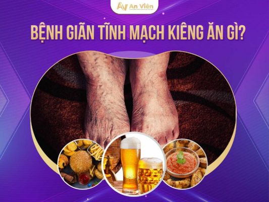 suy giãn tĩnh mạch nên kiêng ăn gì