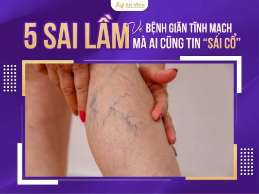 bệnh giãn tĩnh mạch