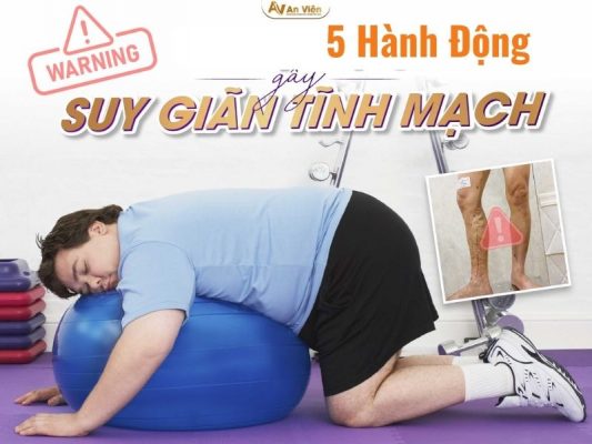 bệnh giãn tĩnh mạch chân