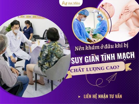 bệnh giãn tĩnh mạch nên khám ở đâu