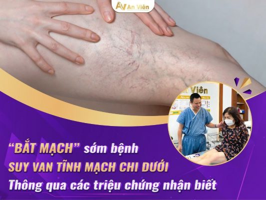 bệnh suy van tĩnh mạch chi dưới