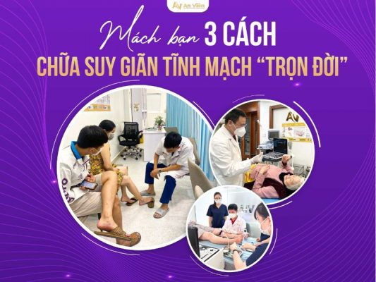 cách chữa suy giãn tĩnh mạch