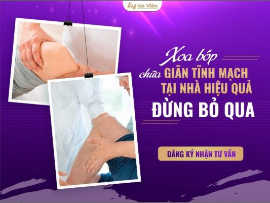 chữa giãn tĩnh mạch tại nhà