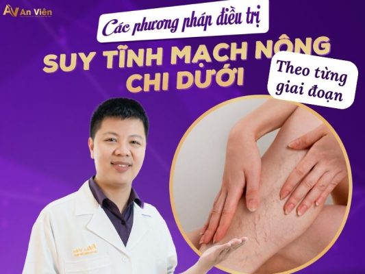 điều trị tĩnh mạch chân