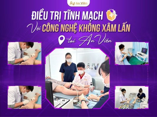 điều trị tĩnh mạch ở chân