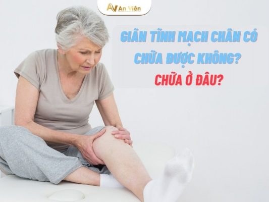 giãn tĩnh mạch chân có chữa được không