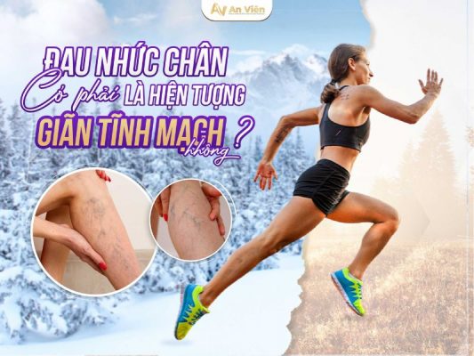hiện tượng giãn tĩnh mạch chânv