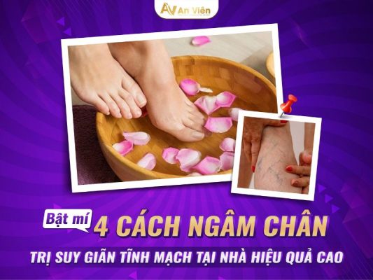 ngâm chân trị suy giãn tĩnh mạch