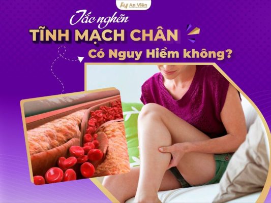 tắc nghẽn tĩnh mạch chân
