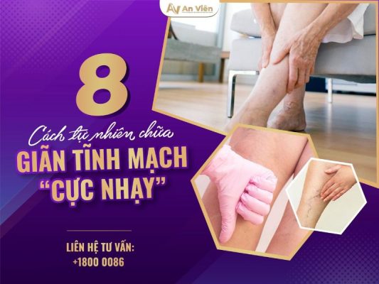 8 cách tự nhiên chữa giãn tĩnh mạch