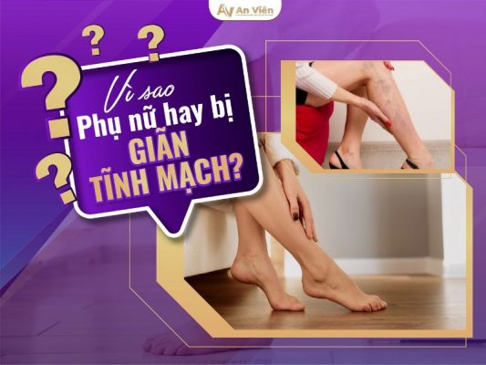 bị giãn tĩnh mạch