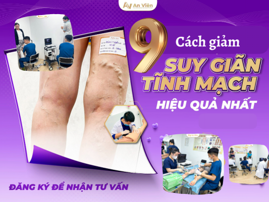 cách giảm suy giãn tĩnh mạch