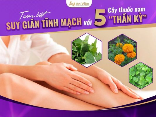 chữa giãn tĩnh mạch