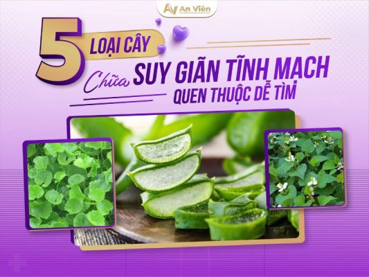 chữa suy giãn tĩnh mạch