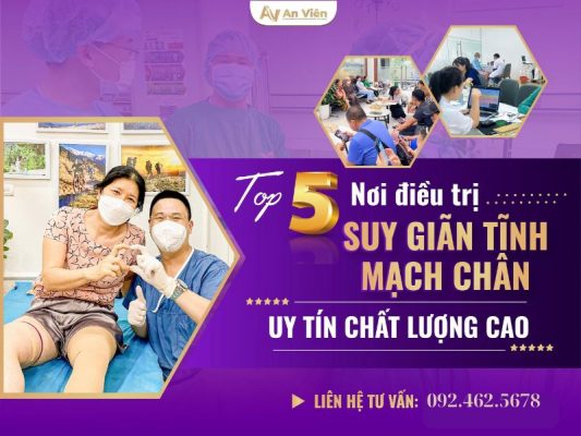 điều trị suy giãn tĩnh mạch chân