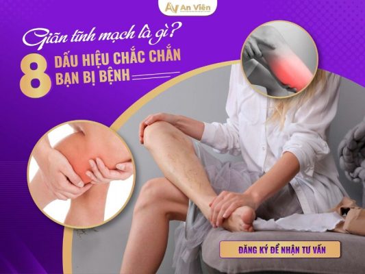 giãn tĩnh mạch là gì