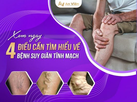 tìm hiểu về bệnh suy giãn tĩnh mạch