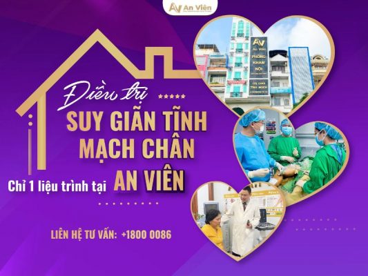 trị giãn tĩnh mạch