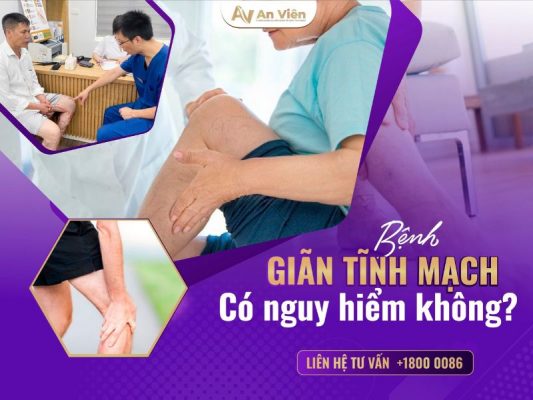 bệnh giãn tĩnh mạch có nguy hiểm không