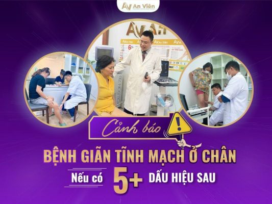 bệnh giãn tĩnh mạch ở chân