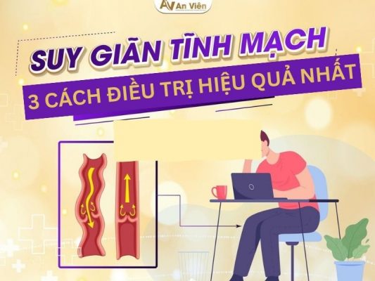 Bệnh suy giãn tĩnh mạch