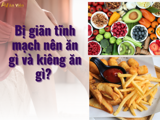 bi gian tinh mach