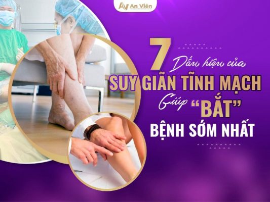 dấu hiệu của suy giãn tĩnh mạch