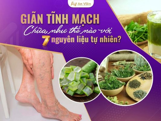giãn tĩnh mạch chữa như thế nào